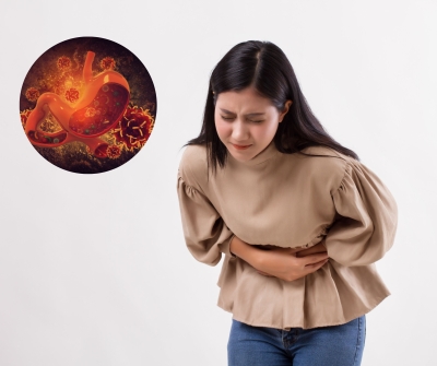 OBAT HERBAL BANTU KAMU BEBAS DARI ASAM LAMBUNG